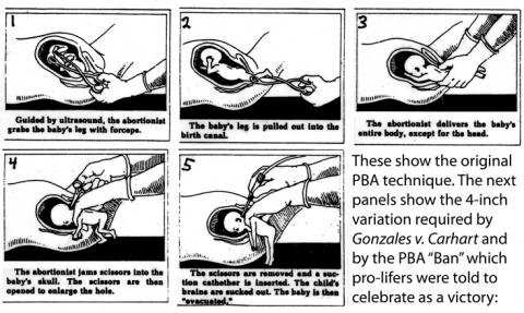 PBA diagrams